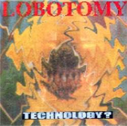 Lobotomy (ARG) : Technology ?